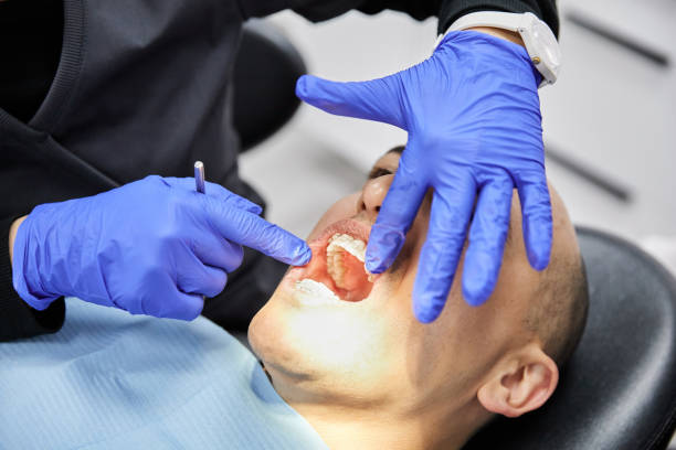 Best Emergency Dental Care for Broken or Chipped Teeth in Utica, MI